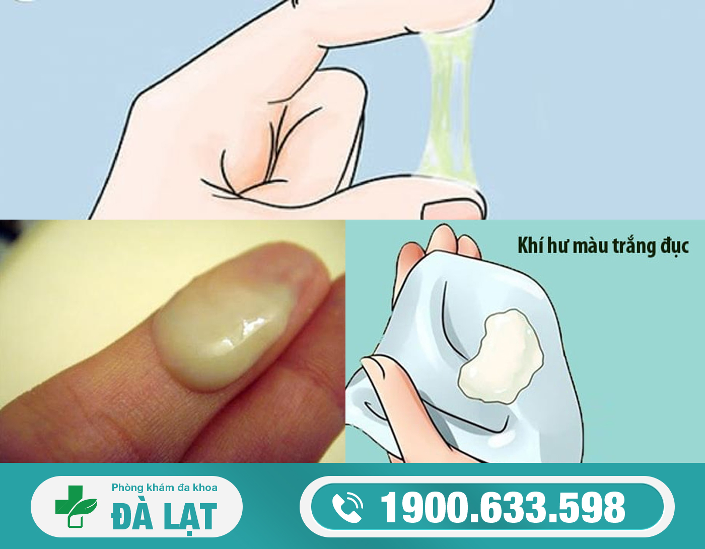 Hình ảnh minh họa